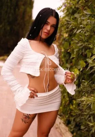 Limerick escorts Amy — 1
